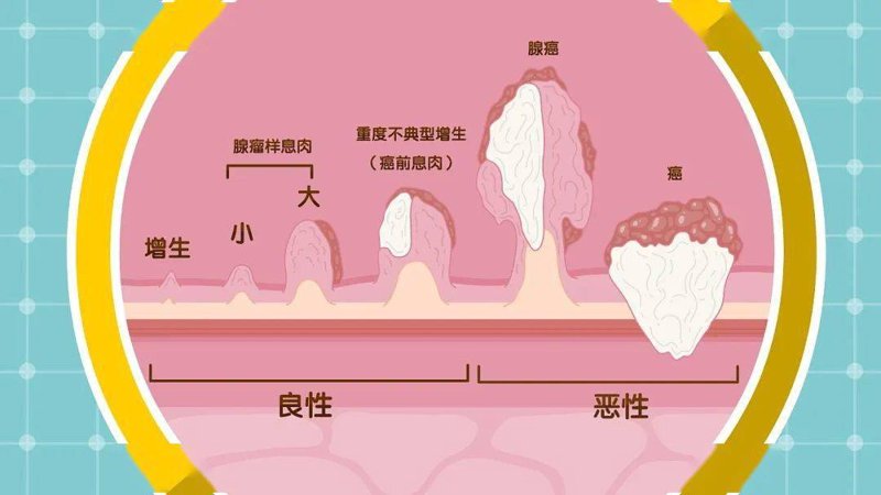 甲基化检测：走出误区，认识真实价值